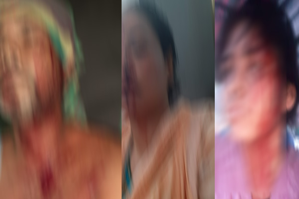 কালিয়াকৈরে একই পরিবারের তিনজনকে পিটিয়ে যখম

