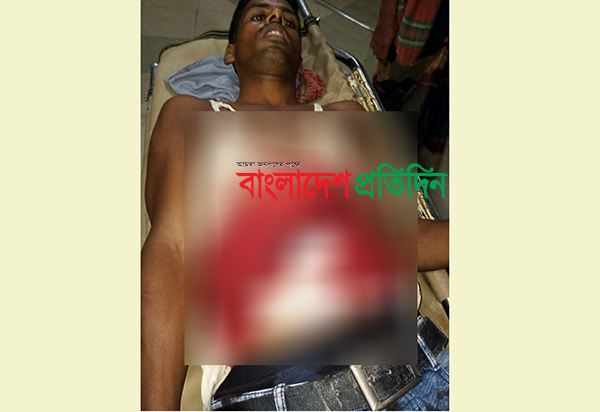 ভাতিজিকে উত্যক্তের প্রতিবাদ করায় বসতবাড়িতে সশস্ত্র হামলা, ছুরিকাঘাতে দুই চাচা আহত 