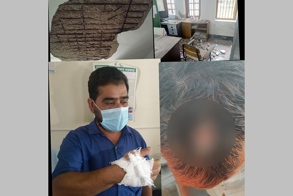 স্বাস্থ্য কমপ্লেক্সের ছাদের পলেস্তারা খসে দুই কর্মচারী আহত