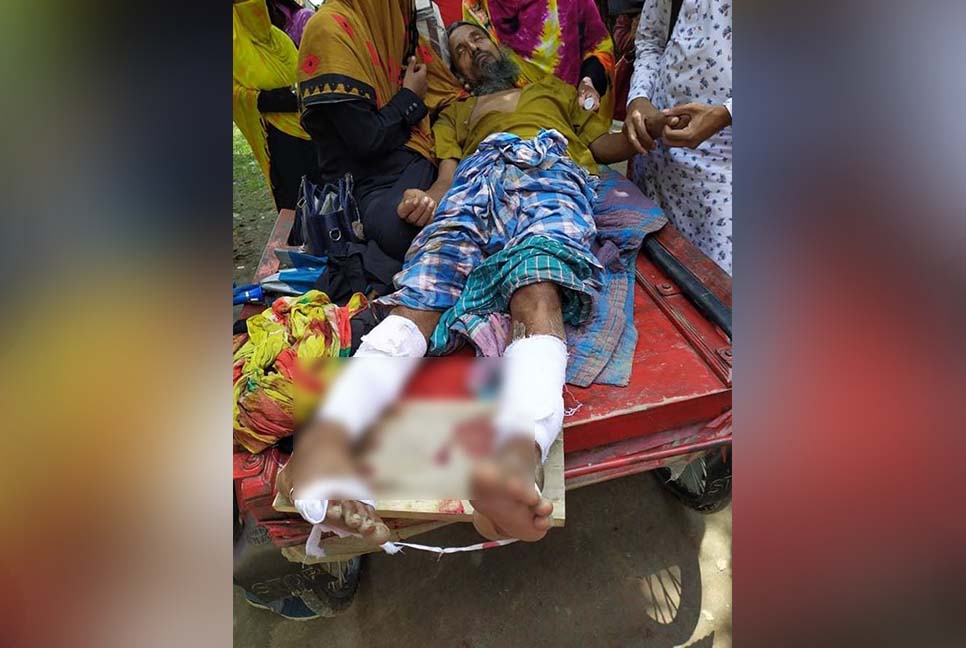 পরাজিত মেম্বার প্রার্থীর দুই পা ভেঙে দিল দুর্বৃত্তরা