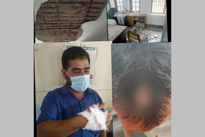 স্বাস্থ্য কমপ্লেক্সের ছাদের পলেস্তারা খসে দুই কর্মচারী আহত