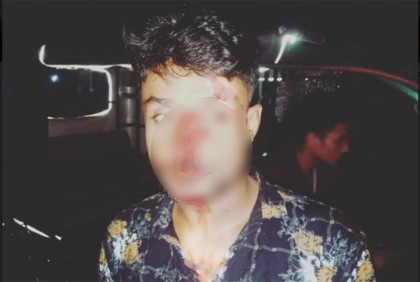 জমি বিরোধে চাচাতো ভাইদের হামলায় আহত সরওয়ার