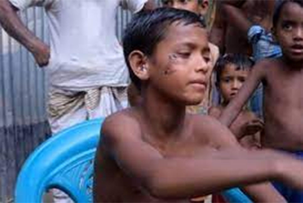 পলাশবাড়ীতে অচেনা প্রাণীর আক্রমণ থামেনি