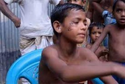 পলাশবাড়ীতে অচেনা প্রাণীর আক্রমণ থামেনি