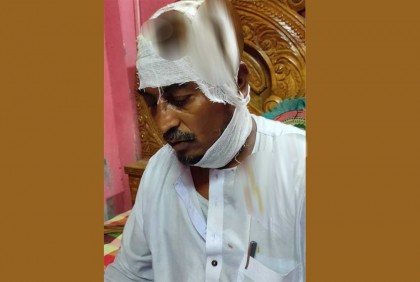 মোটরসাইকেলে মহড়া দিয়ে চেয়ারম্যান প্রার্থীর মাথা ফাটালেন তারা

