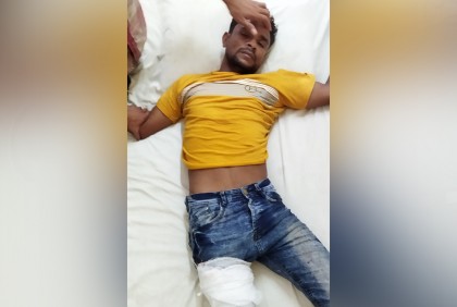 যুবককে কুপিয়ে জখম করল সাবেক প্রেমিকা 