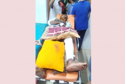 ‘পূর্ব শত্রুতার’ জেরে কৃষকের পায়ের রগ কেটে দিল দুর্বৃত্তরা