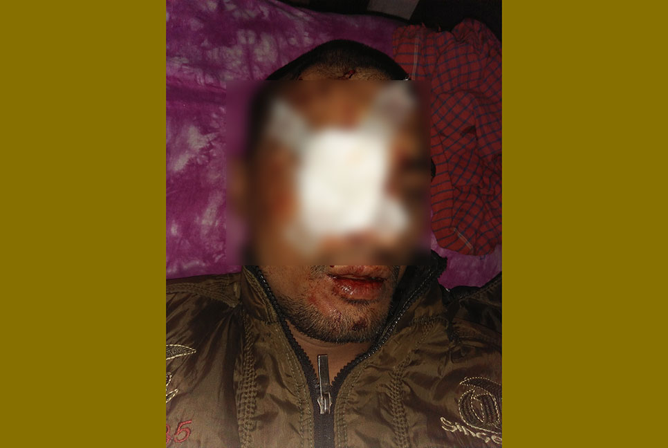 পাটগ্রামে বিএসএফের গুলিতে যুবক আহত 