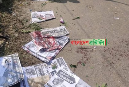 নির্বাচনী সহিংসতা; কুমিল্লায় গুলিবিদ্ধ একজনের মৃত্যু
