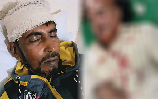 বাগেরহাটে সন্ত্রাসী হামলায় বিএনপির ১০ নেতাকর্মী আহত