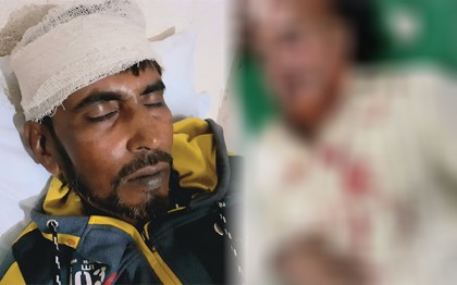 বাগেরহাটে সন্ত্রাসী হামলায় বিএনপির ১০ নেতাকর্মী আহত