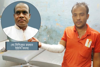 দোকানির শরীরে ‘ফুটন্ত গরম’ পানি ঢেলে দিলেন ইউপি সদস্য!