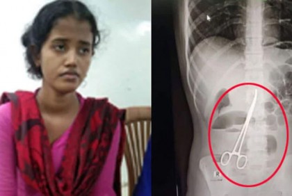 ২ বছর ধরে পেটের ভেতর কাঁচি ৩ ঘণ্টার অস্ত্রোপচারে বের হলো 

