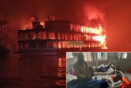 চিকিৎসাধীন কালু সন্ধান চান পরিবারের বাকি ১০ সদস্যের