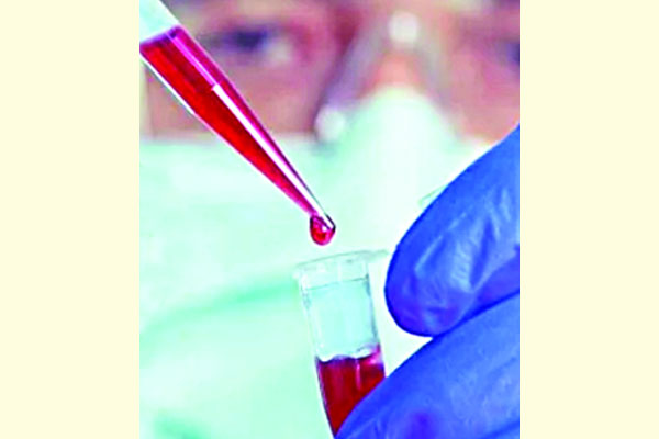 বাধ্যতামূলক হচ্ছে ডোপ টেস্ট