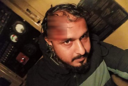 চলন্ত ট্রেনে ছোড়া ঢিলে চালক আহত

