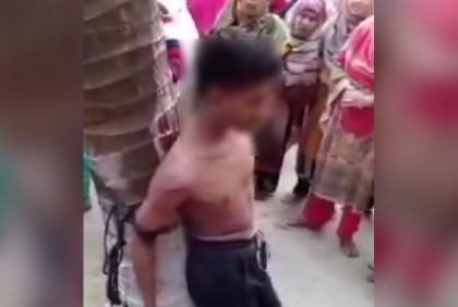 প্রেমিককে বাড়িতে ডেকে গাছে বেঁধে নির্যাতন, দুই পা ভেঙে দেওয়ার অভিযোগ