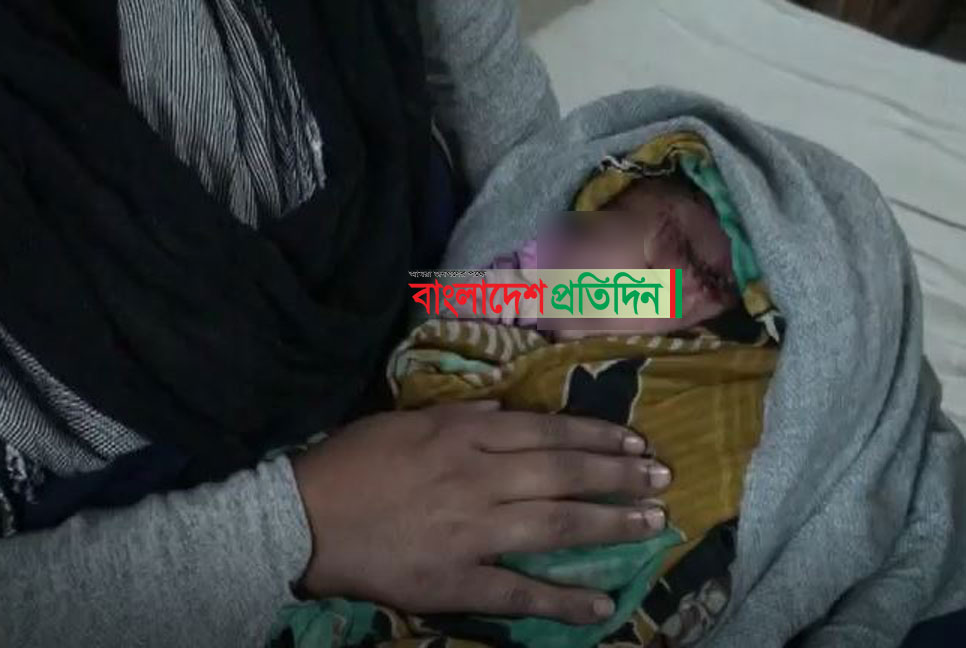 আয়া দিয়ে প্রসূতির সিজার, কেটে ফেলা হল নবজাতকের কপাল!