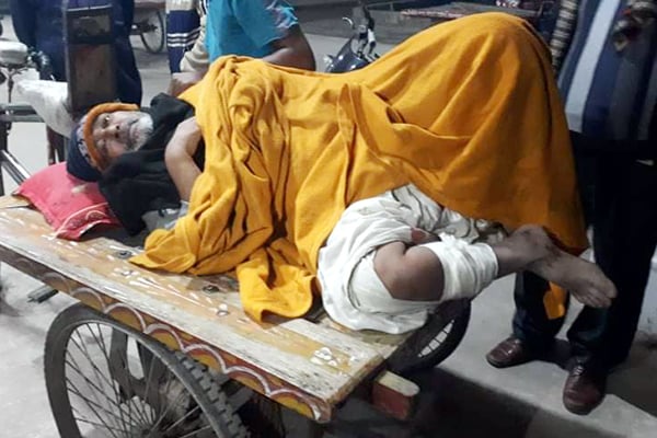 বোয়ালমারীতে নির্বাচন পরবর্তী সহিংসতায় ষাটোর্ধ্ব বৃদ্ধের পা ভাঙল দুর্বৃত্তরা