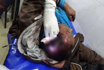 ফুলপুরে বালিয়া ইউনিয়নে নির্বাচনী সহিংসতায় আহত ১৩  