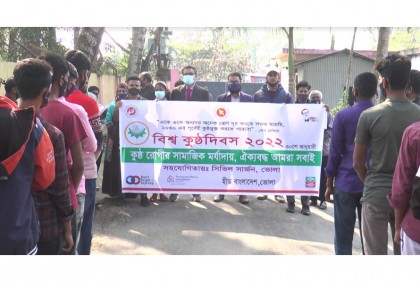 ভোলায় বিশ্ব কুষ্ঠ দিবস পালিত