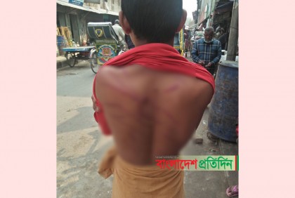 রাতে মোবাইল চালানোয় মাদ্রাসাছাত্রকে নির্যাতনের অভিযোগ