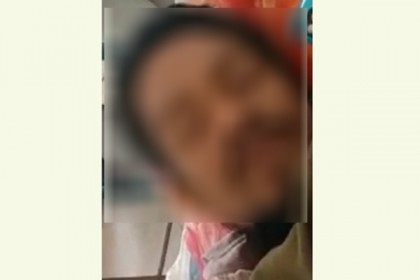 স্বামীর বিশেষ অঙ্গ কর্তন