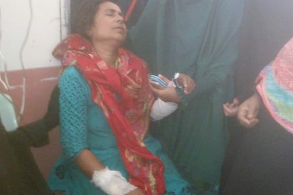 ফুলপুরে শিয়ালের কামড়ে এক নারী আহত 