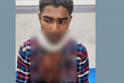 চকরিয়ায় গলা কেটে যুবকের টাকা ছিনতাই