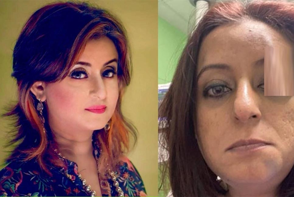 হাসপাতালে পড়ে গিয়ে গুরুতর আহত আলিফ