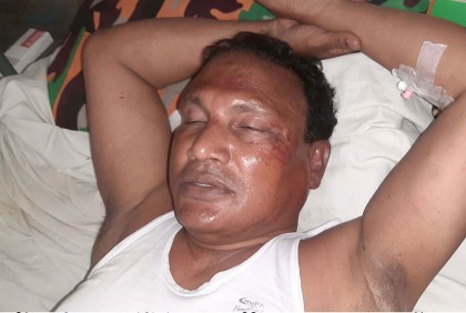 স্কুলশিক্ষককের সাথে মারপিটের ঘটনায় হাসপাতালে আওয়ামী লীগ নেতা