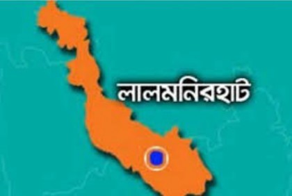 যৌতুকের টাকা না পেয়ে স্ত্রীর চুল কেটে দিলেন মাদকাসক্ত স্বামী