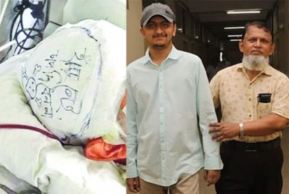 ‘হাড় নেই, চাপ দেবেন না’: সুস্থ হয়ে বাসায় ফিরেছেন সেই আকিব
