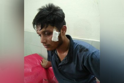 বগুড়া আজিজুল হক কলেজে দুই গ্রুপের সংঘর্ষ