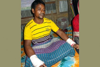 দিনমজুরকে পিটিয়ে হাত ভাঙার অভিযোগ চেয়ারম্যানের বিরুদ্ধে
