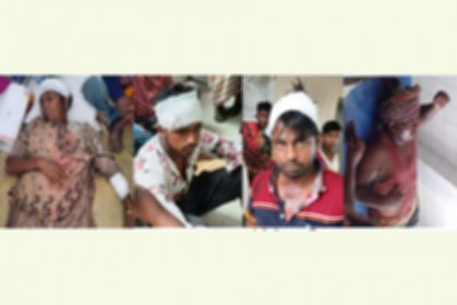 উল্লাপাড়ায় জমির বিরোধ নিয়ে সংঘর্ষে নারীসহ ১৫ জন আহত