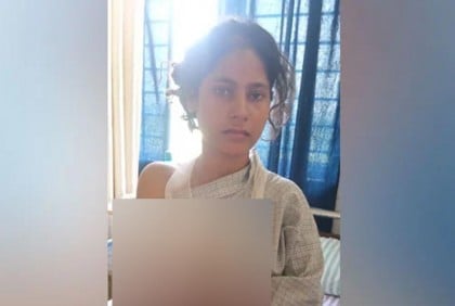 স্ত্রী সরকারি চাকরি পাওয়ায় হাত কেটে ফেলার অভিযোগ