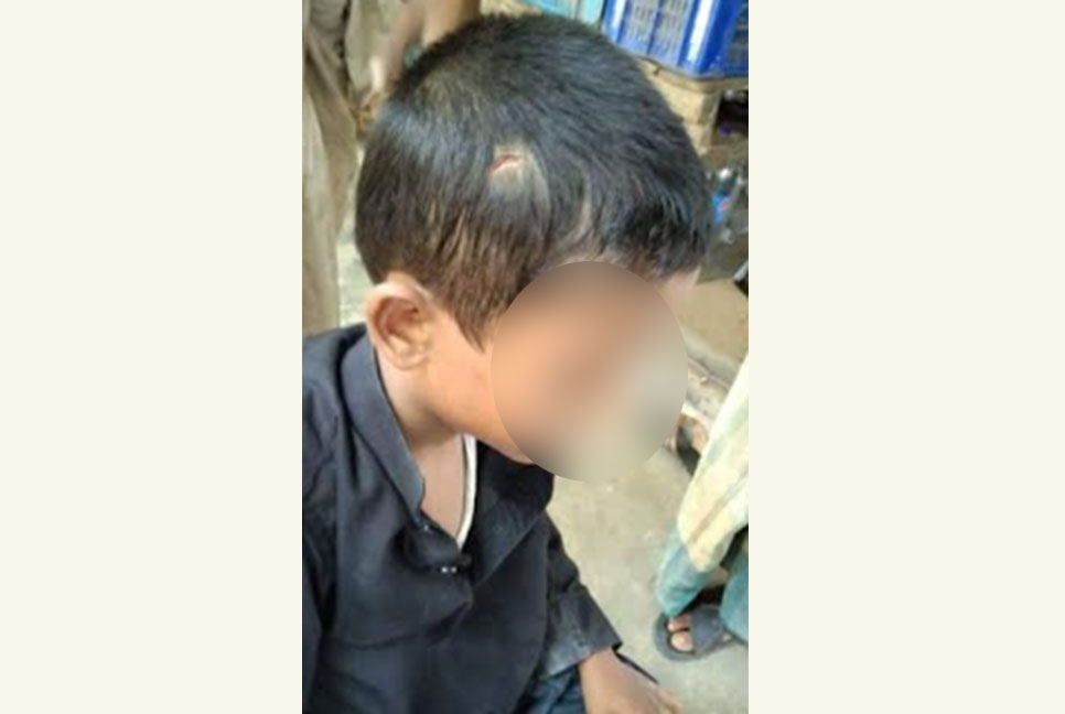 চুল কাটতে গিয়ে ছাত্রের মাথা কেটে ফেললেন শিক্ষক