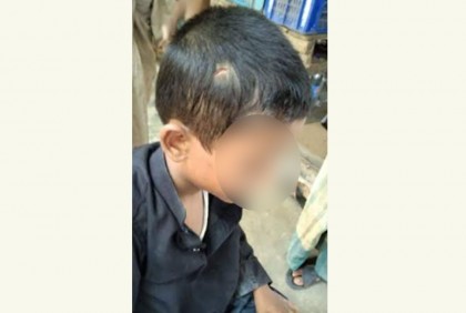 চুল কাটতে গিয়ে ছাত্রের মাথা কেটে ফেললেন শিক্ষক