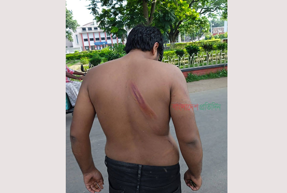 রাবি ছাত্রলীগ সভাপতির বিরুদ্ধে কর্মীকে পেটানোর অভিযোগ