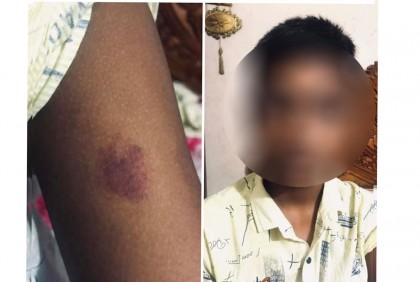 চুল না কাটার অপরাধে ৫ম শ্রেণির ছাত্রকে পিটিয়ে জখম