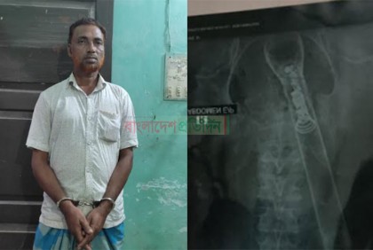 বৃদ্ধের পায়ুপথে টর্চলাইট ঢুকিয়ে নির্যাতন; সেই যুবলীগ নেতা গ্রেফতার