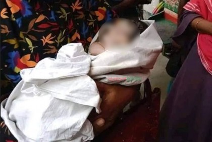 আঘাত পেলেও শঙ্কামুক্ত সেই নবজাতক