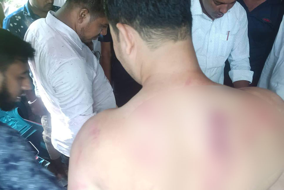 নোয়াখালীতে কেন্দ্রীয় ছাত্রদল নেতার ওপর হামলা