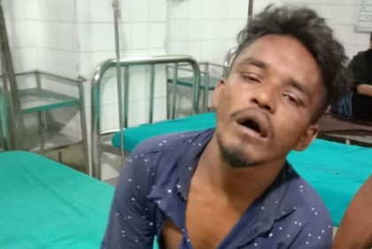 স্বর্ণের চেইন গিলে ফেললো ছিনতাইকারী, অতঃপর...

