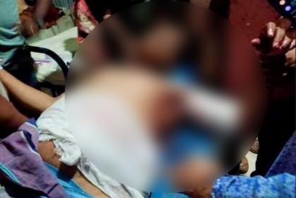 মাদারীপুরে স্বেচ্ছাসেবক লীগ নেতার ওপর সন্ত্রাসী হামলা