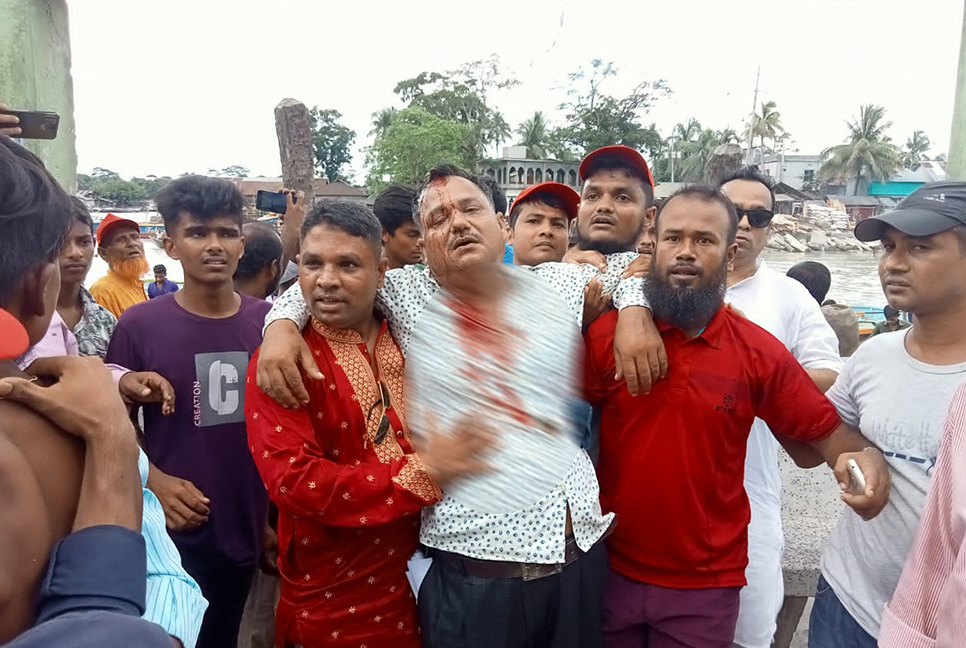 বিএনপি’র বিক্ষোভে হামলার অভিযোগ, আহত- ২৫