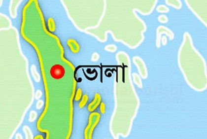 ভোলায় কোমর জোড়া লাগানো যমজ শিশুর জন্ম