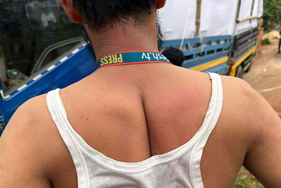 সাংবাদিককে মারধর করলেন বিএনপির কর্মীরা

