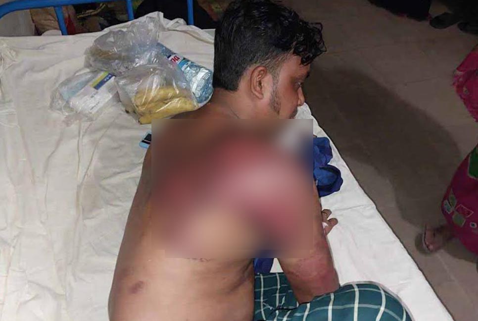 রাজৈরে চুরির অপবাদে ফল ব্যবসায়ীকে নির্যাতন, গ্রেফতার ১